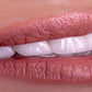 Steenwit smile