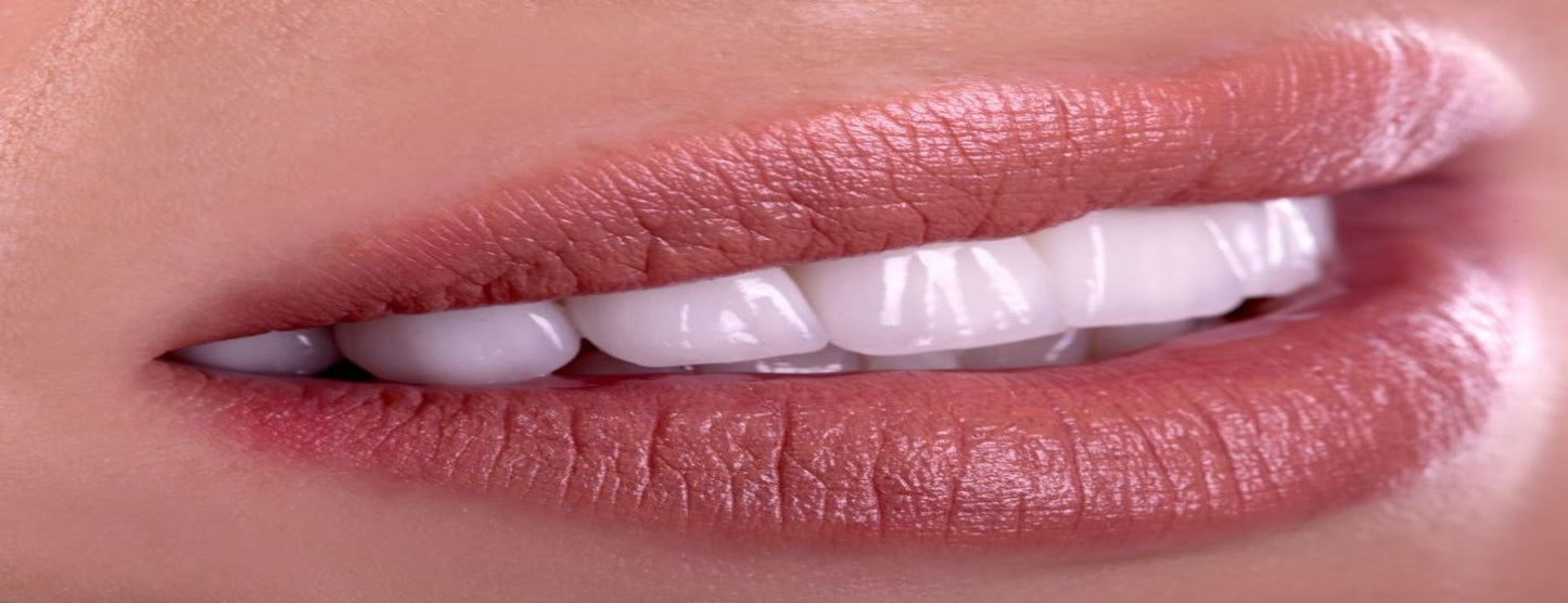 Steenwit smile
